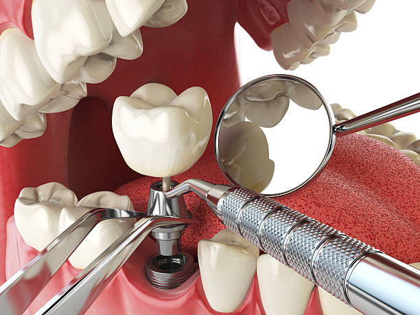 Best Walk-In Emergency Dental Services in Brent, FL